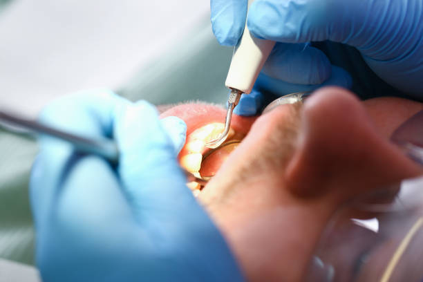 Best Dentist for Tooth Abscess  in Robstown, TX